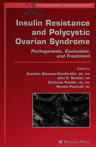 Insulin Resistance and Polycystic Ovarian Syndrome