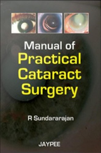 Manual of Practical Cataract Surgery