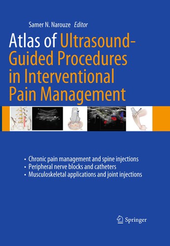 Atlas of ultrasound-guided procedures in interventional pain management