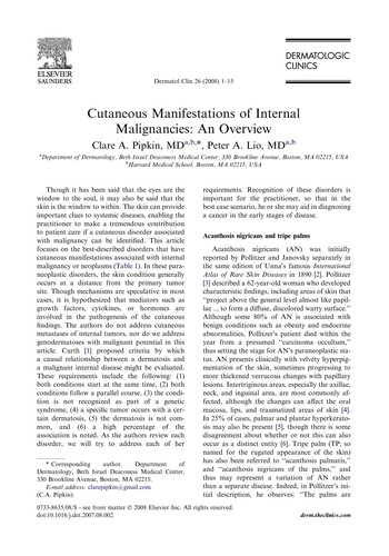 Internal Malignancy and the Skin