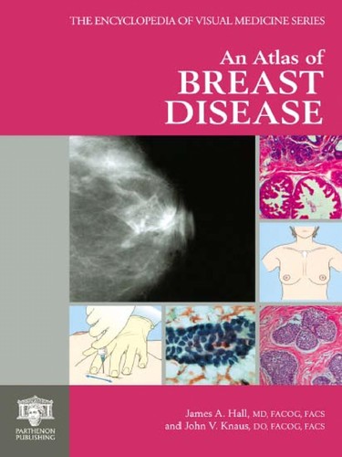 Atlas of Breast Disease
