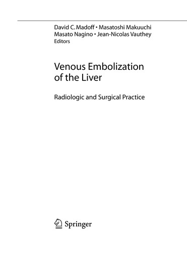 Venous embolization of the liver