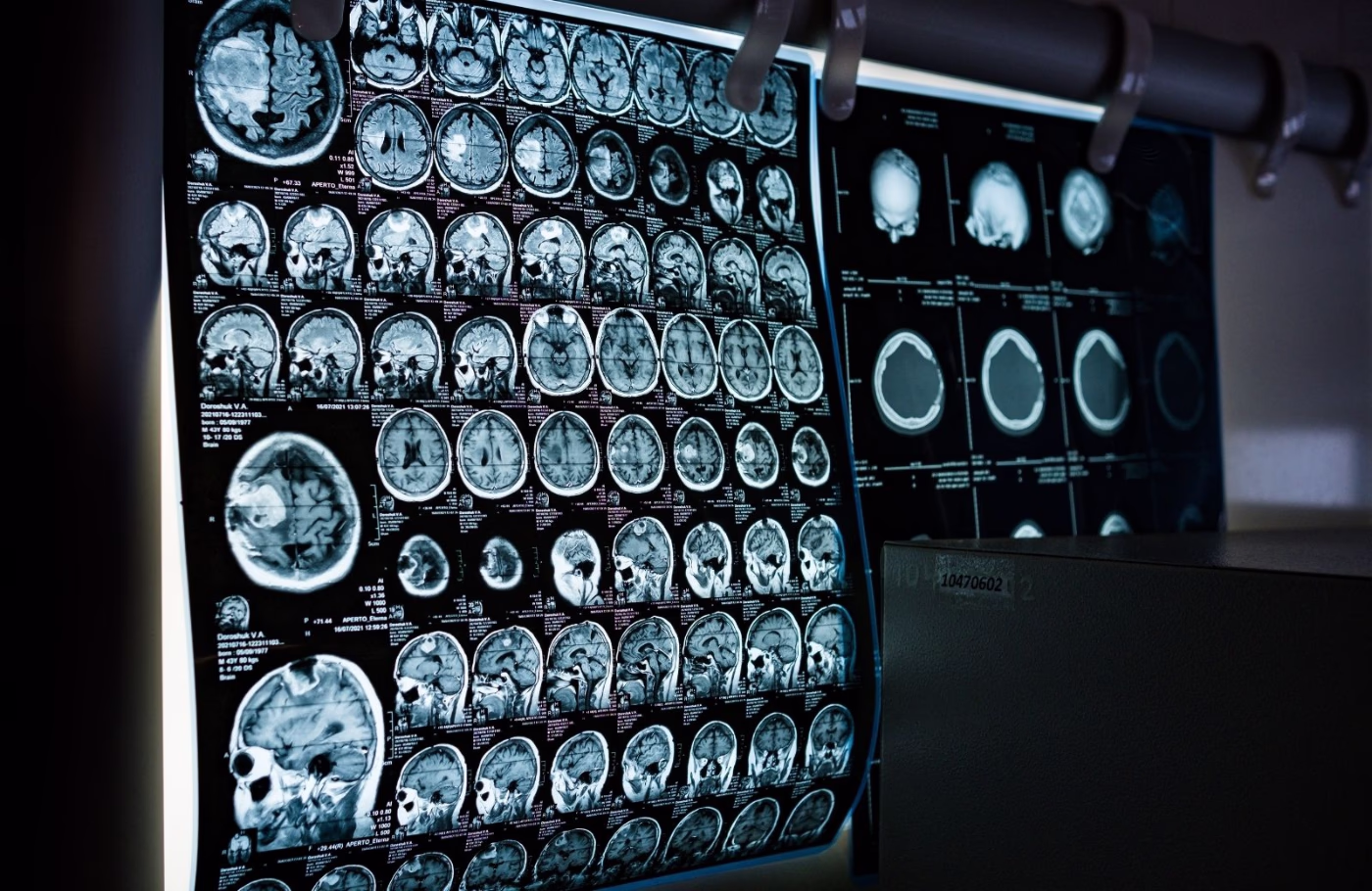 Imagen del curso: Neuroanatomía Funcional Aplicada a la Neurorrehabilitación