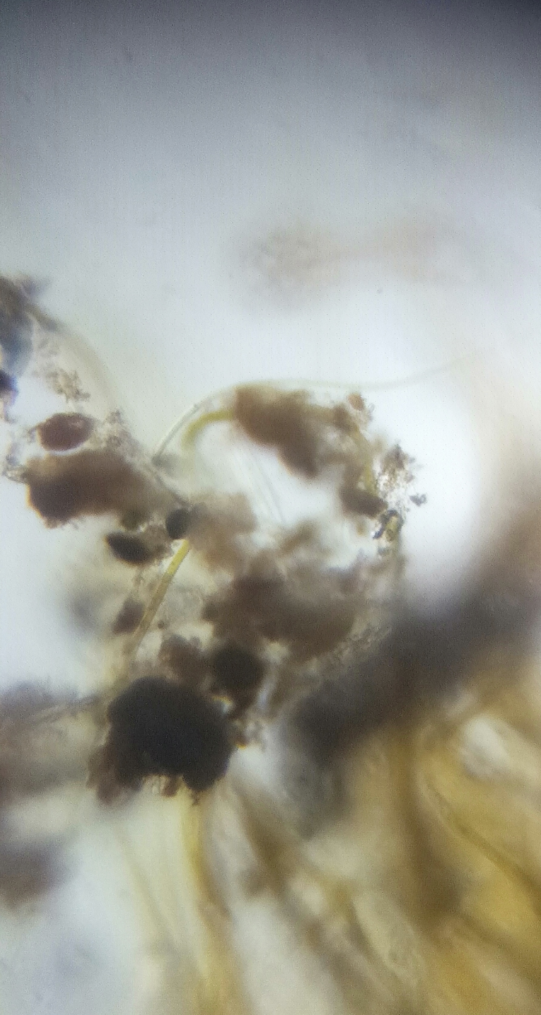 8a1b5a0e-8579-44d9-94bc-3466a2e44bc9.foldscope