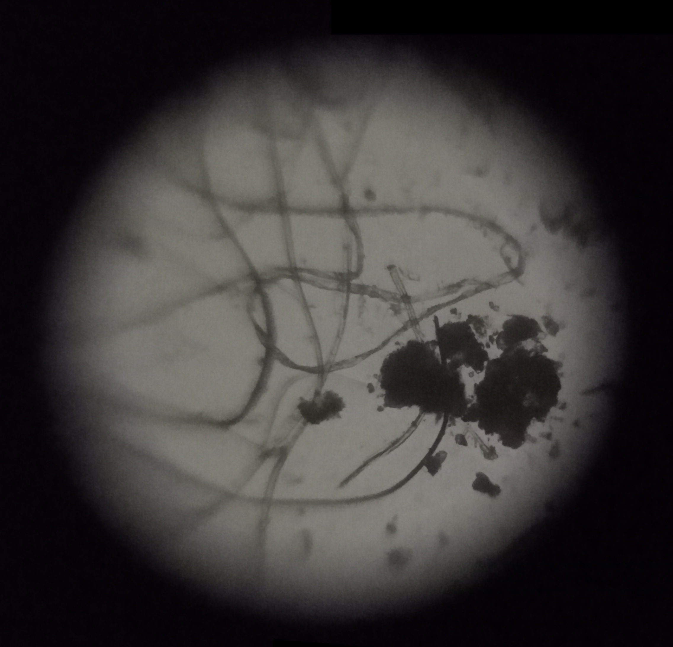 3039c69c-afa0-4ae5-9d4b-e7df0a53ae63.foldscope