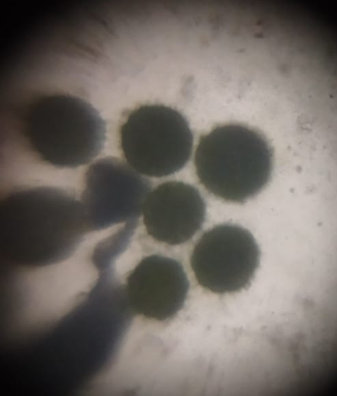 aaa2ba75-b10e-45f7-94af-e3e52599f695.foldscope