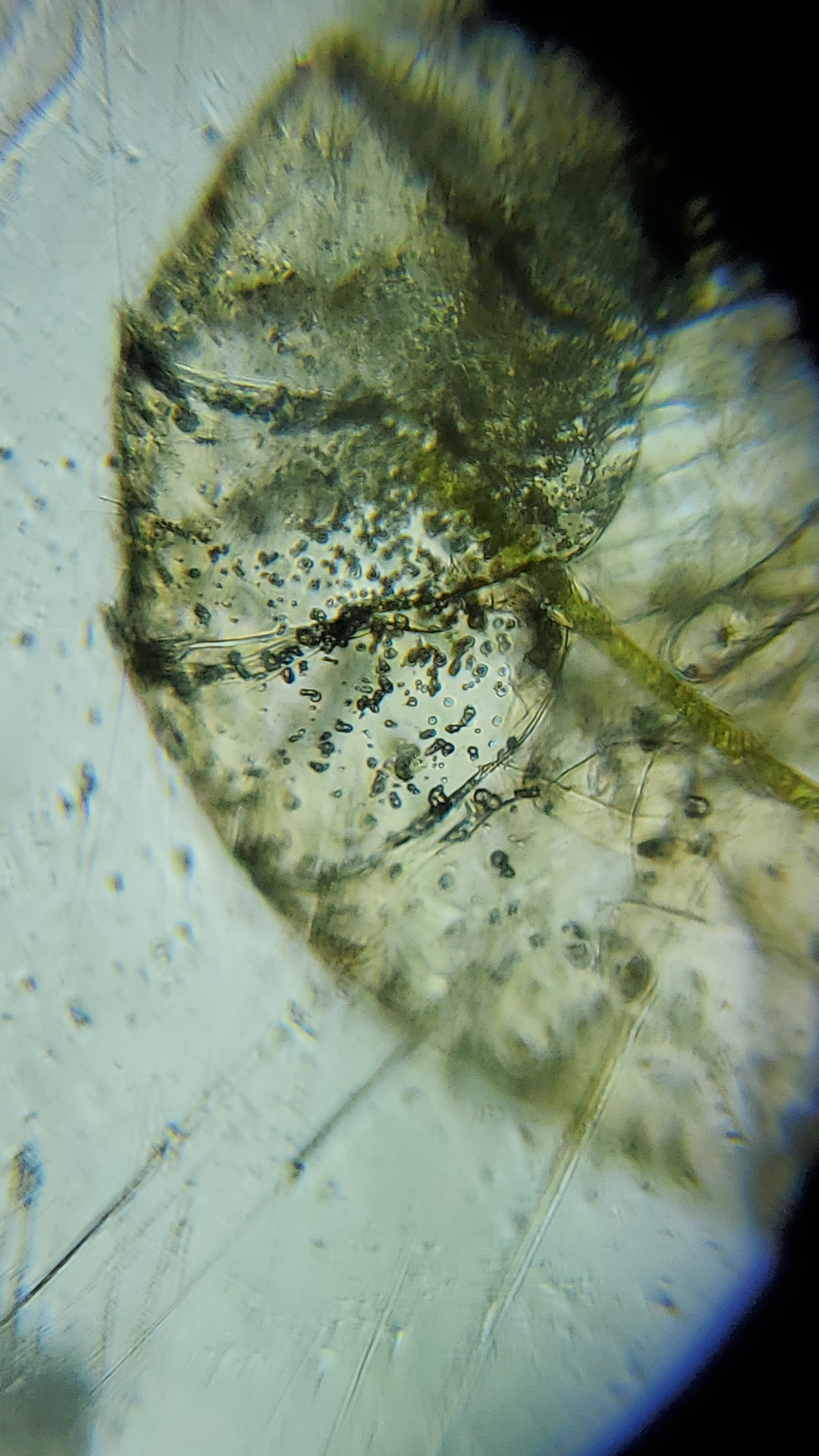 128fb0f6-6b50-4209-961c-2d1ee20d88bc.foldscope