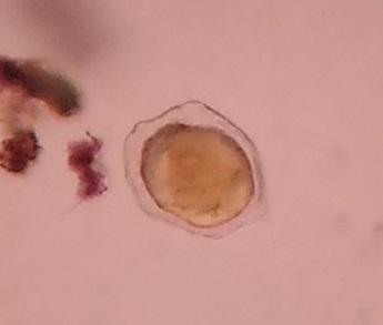 Hookworm-egg-1.jpg