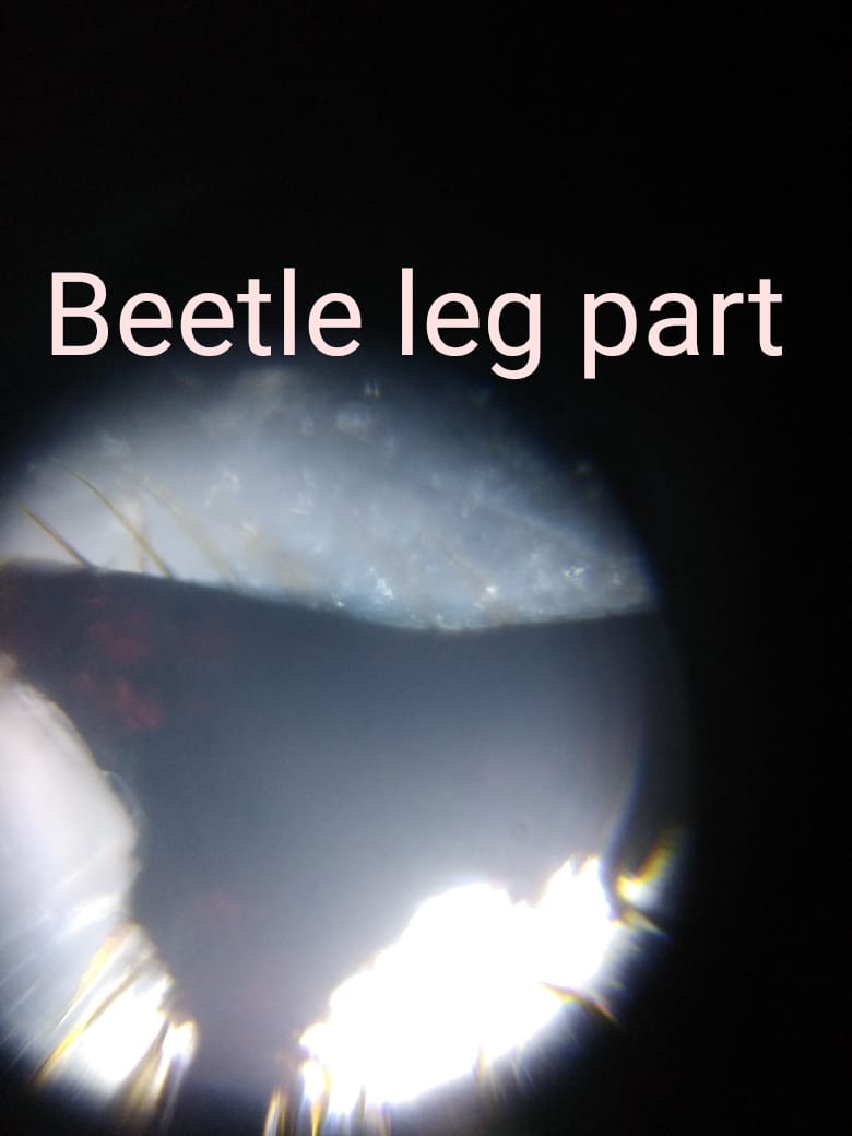 beetle-leg.jpeg