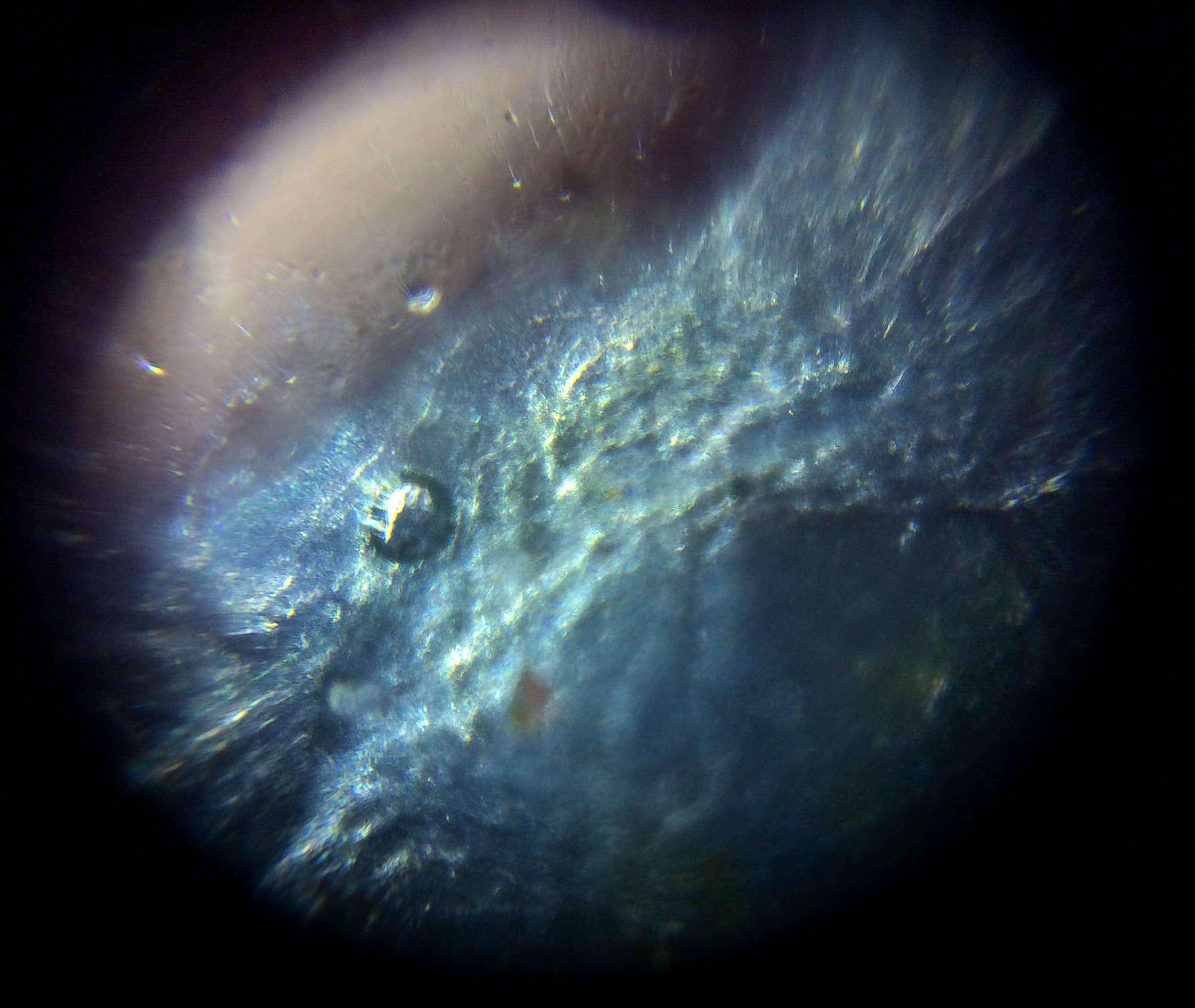 Foldscope_cheek.jpg