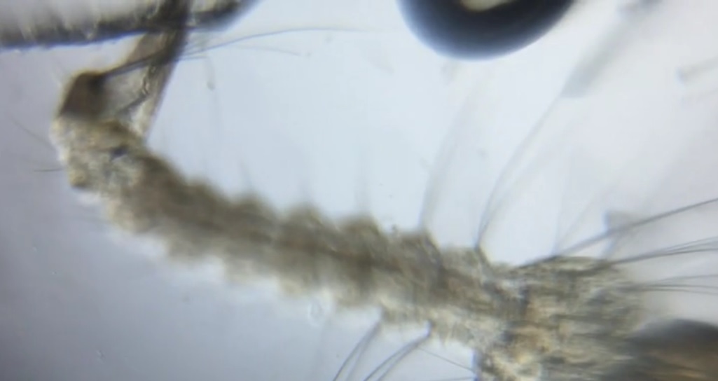 aedis-mosquito-larvae.jpg