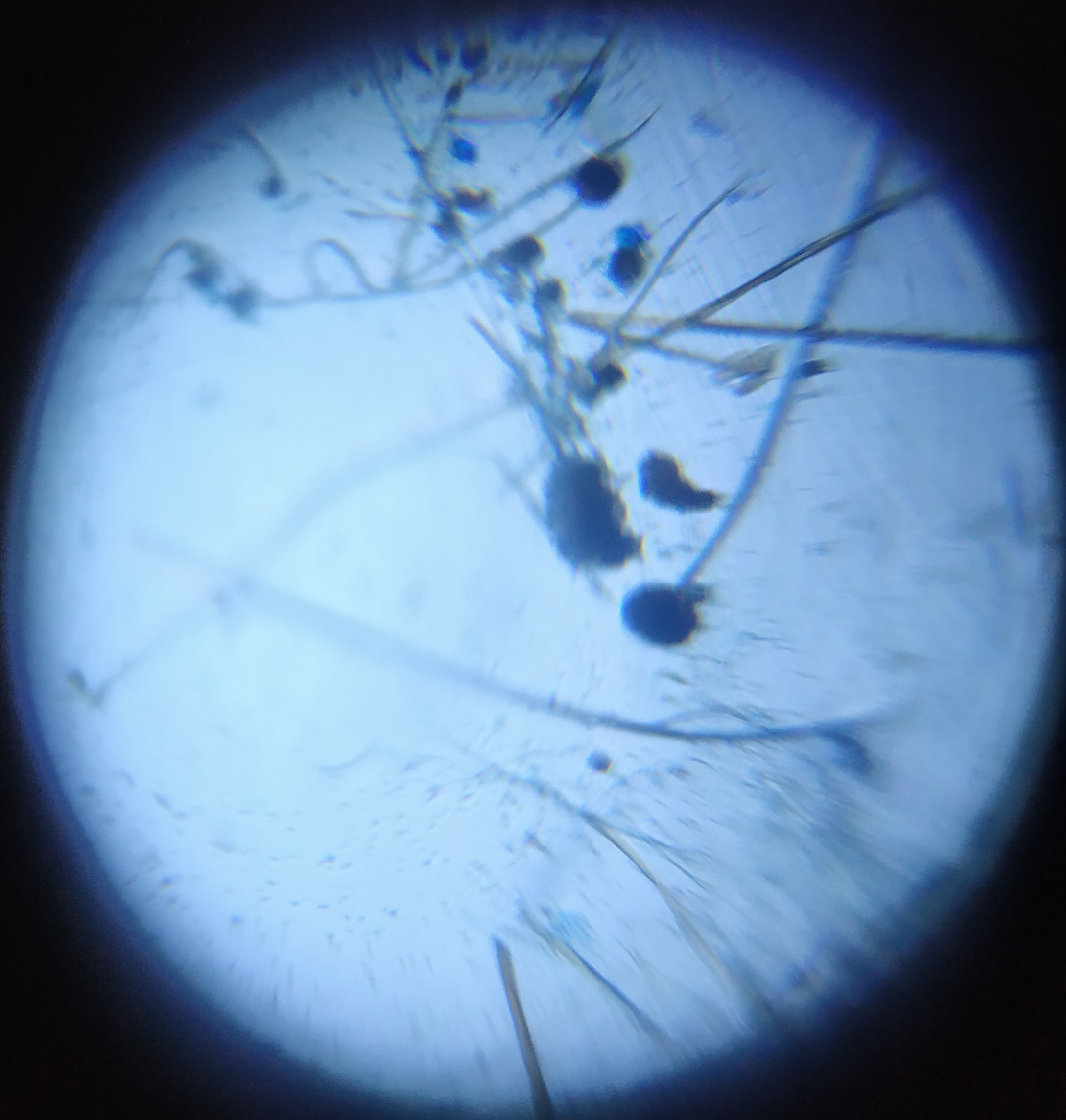 Rhizopus-sp..jpg