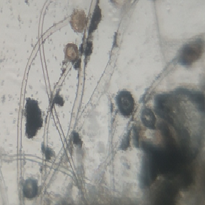aspergillus.png