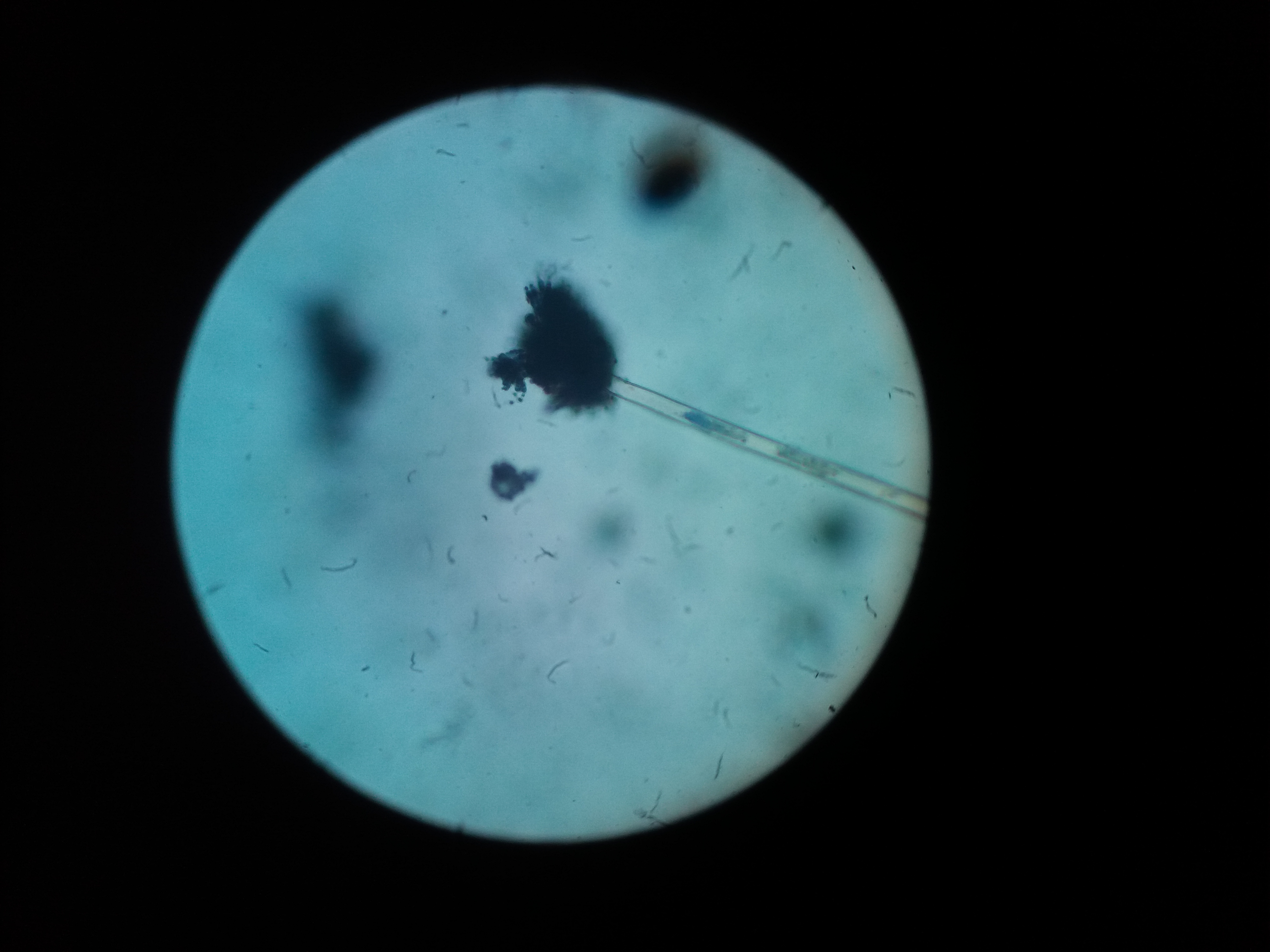Aspergillus-niger-stained-image-microscope.jpg