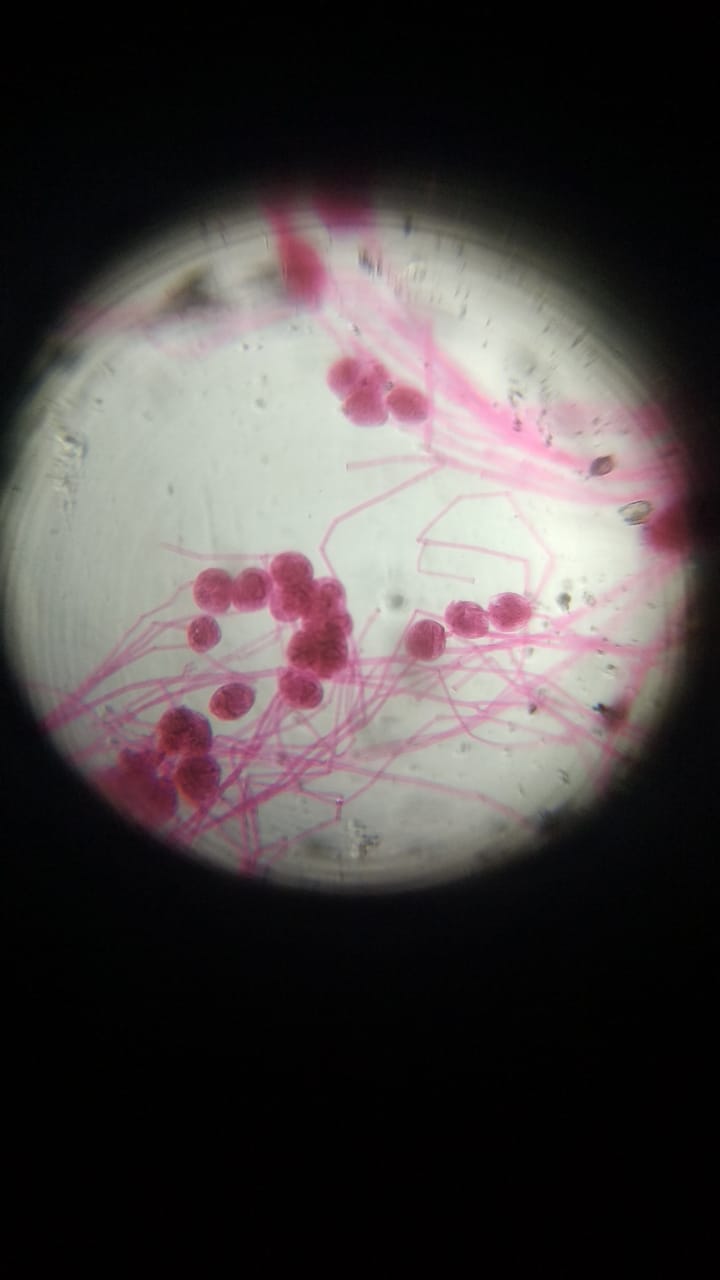 vorticella.jpeg