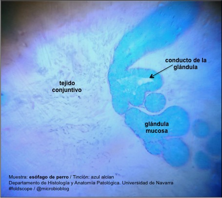 esofago3.jpg