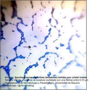 levaduras.jpg