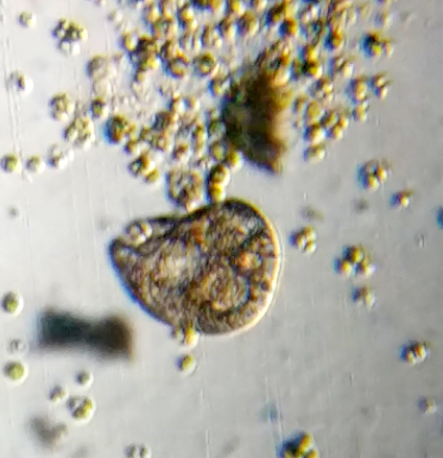 Microbial conflict in action: The fascinating world of amoebae, image size:1513x1564