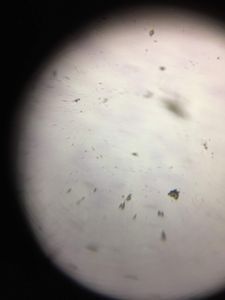 Thumbnail for Hawk Blood Smear, California (ID: 7)