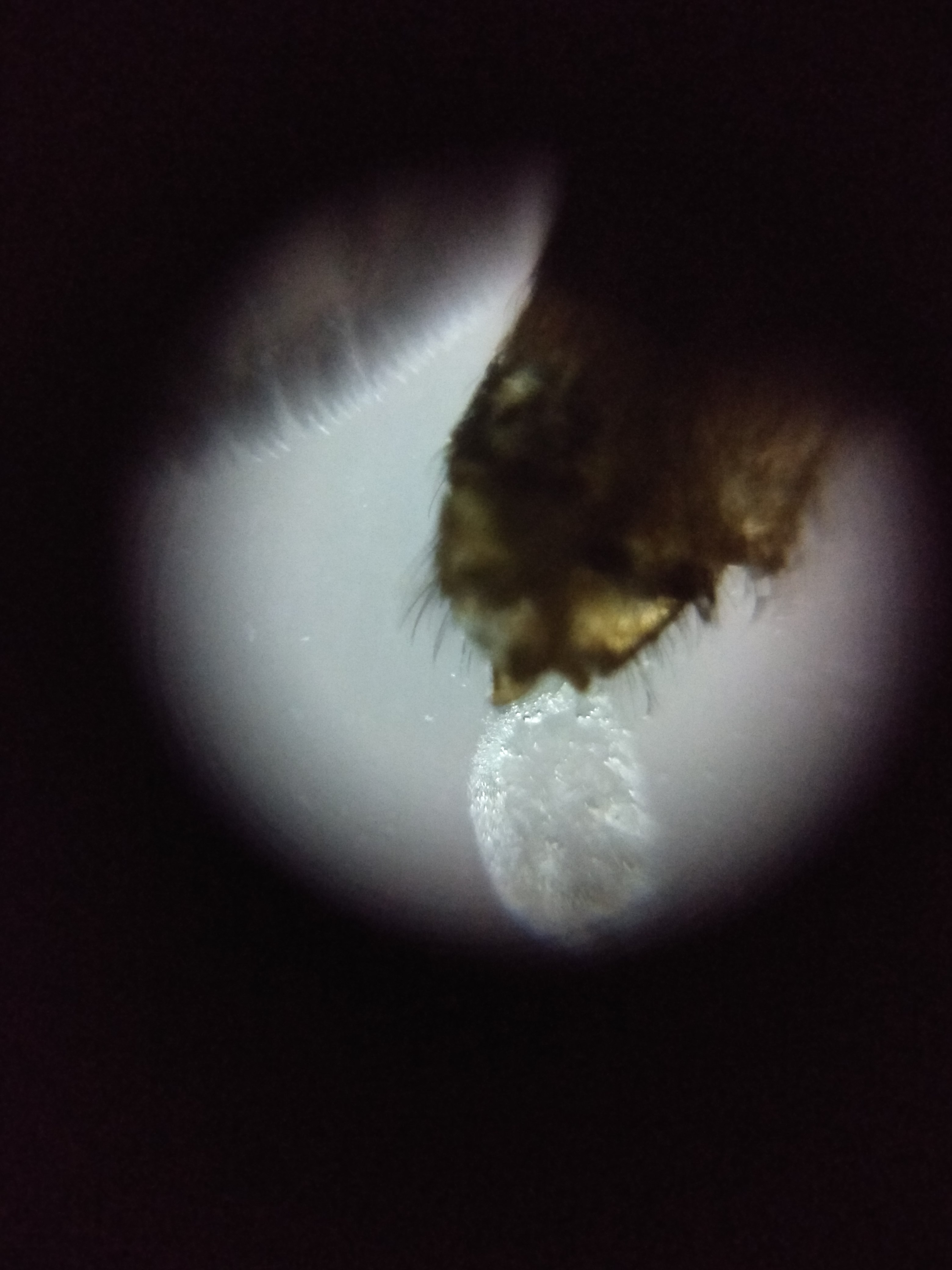some-secretion-outing-from-mosquito-lower-part.jpg