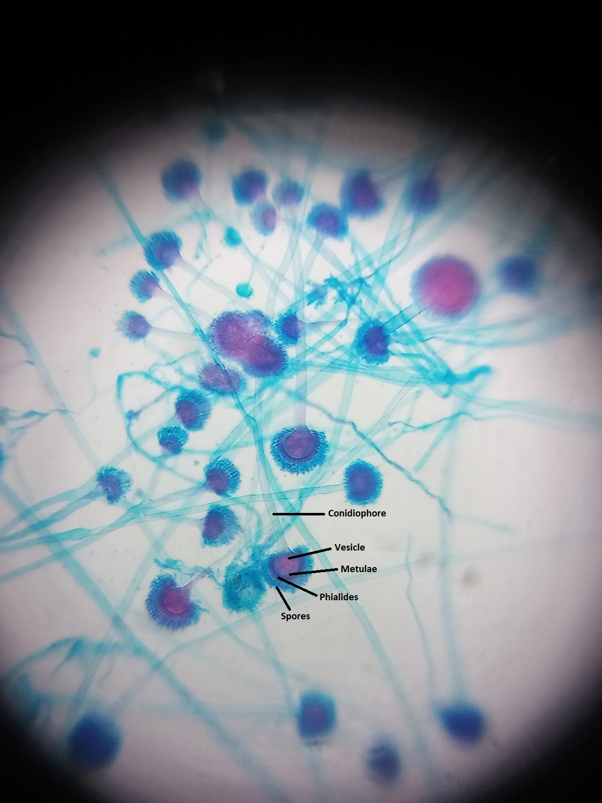 Aspergillus.jpg