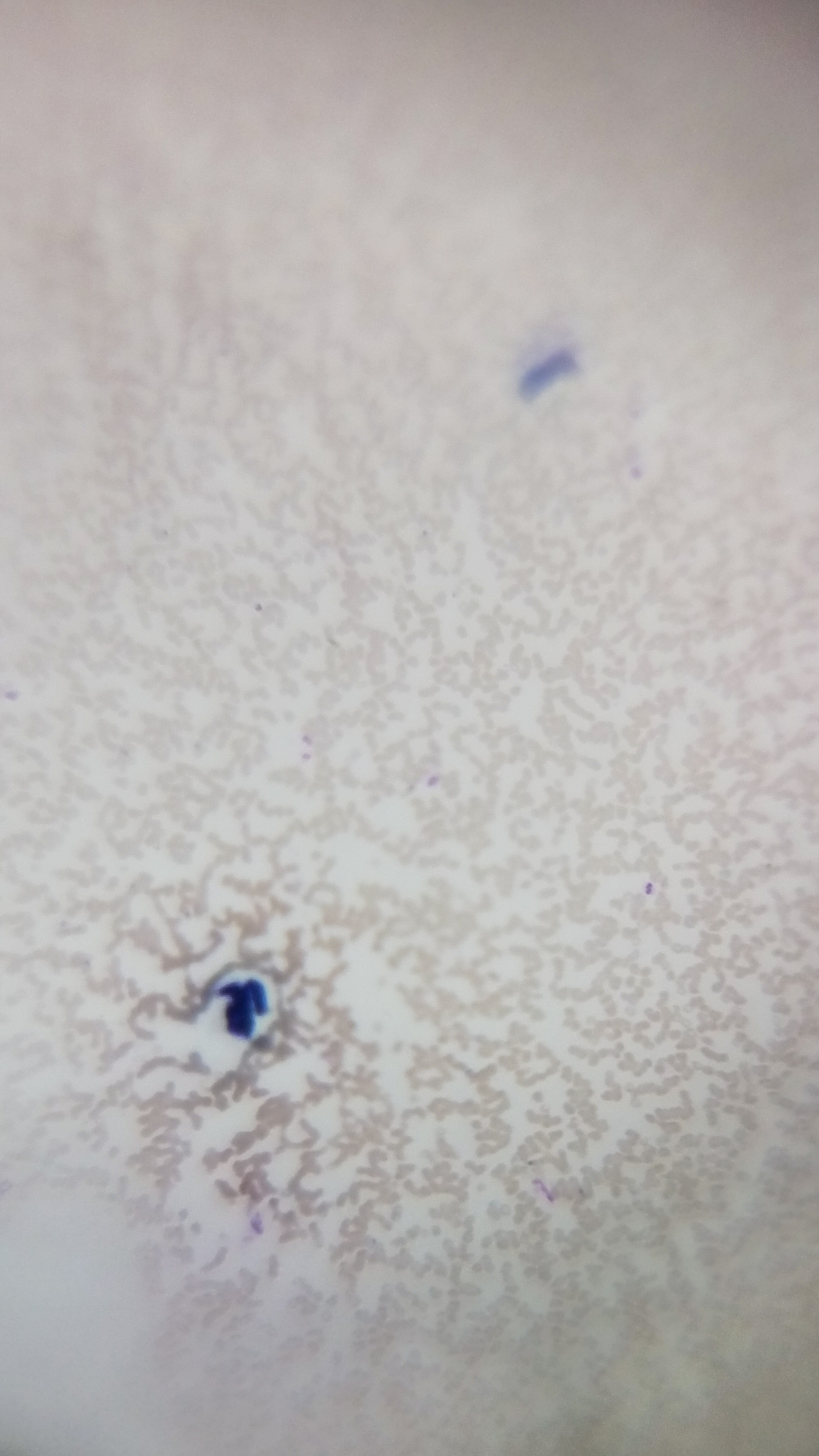 Malaria_LowMag_Foldscope.jpg