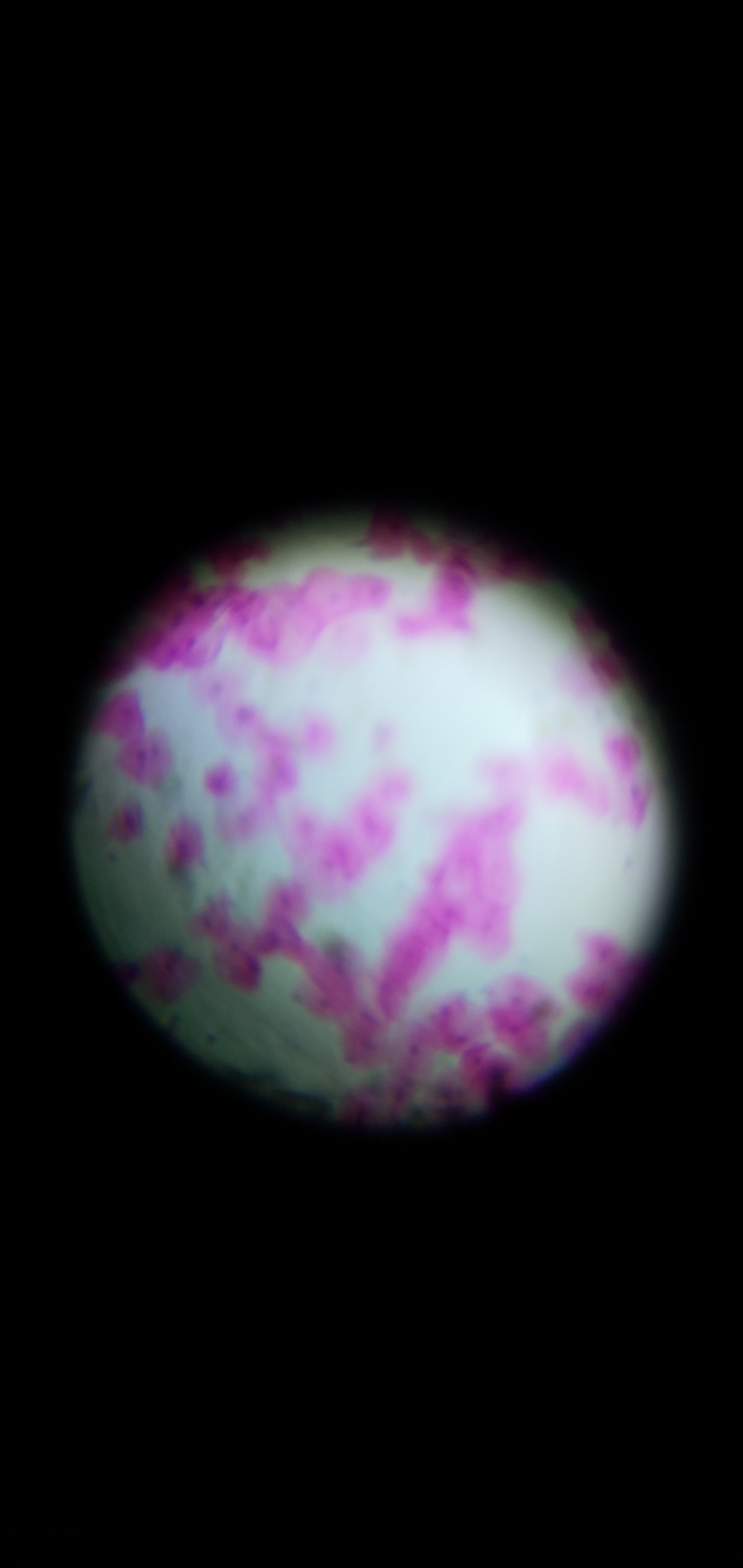 squamous-epithelium.jpg