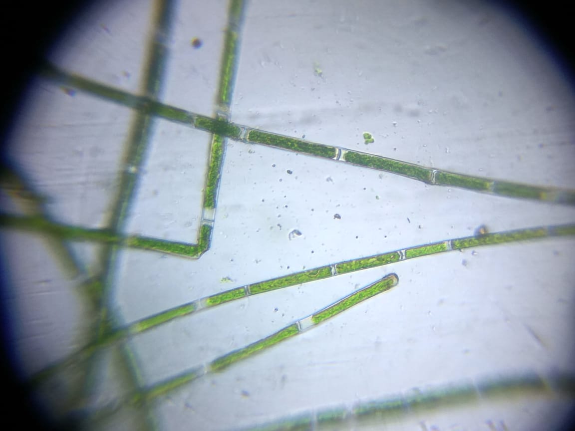 Rhizoclonium.jpg