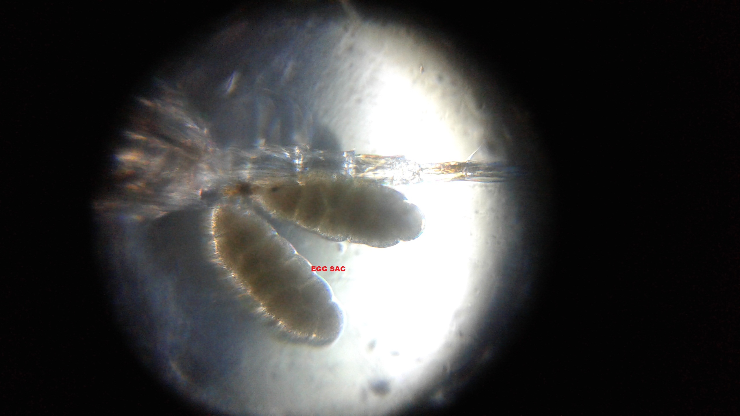 COPEPOD-WITH-EGG-SAC.jpg