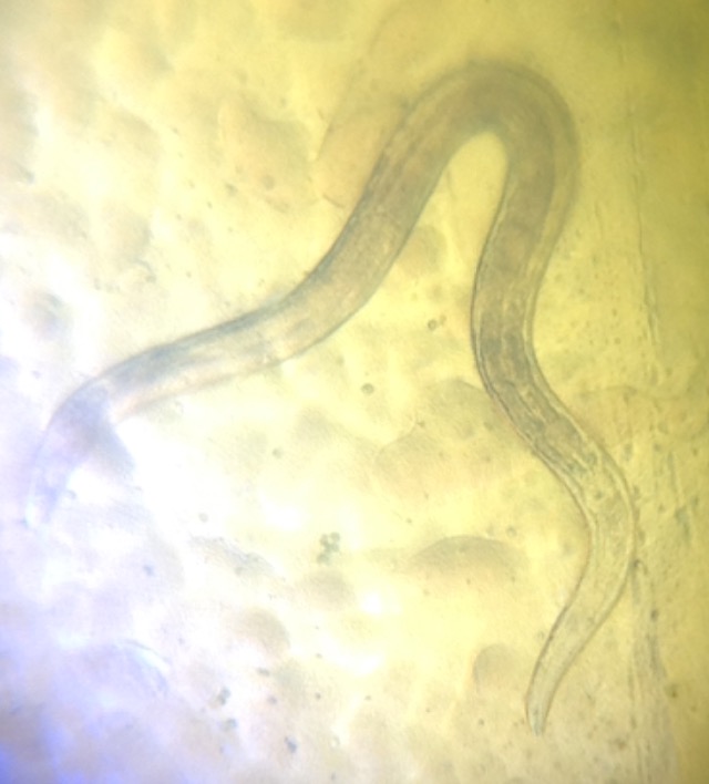Nematode-in-water-sample.jpg
