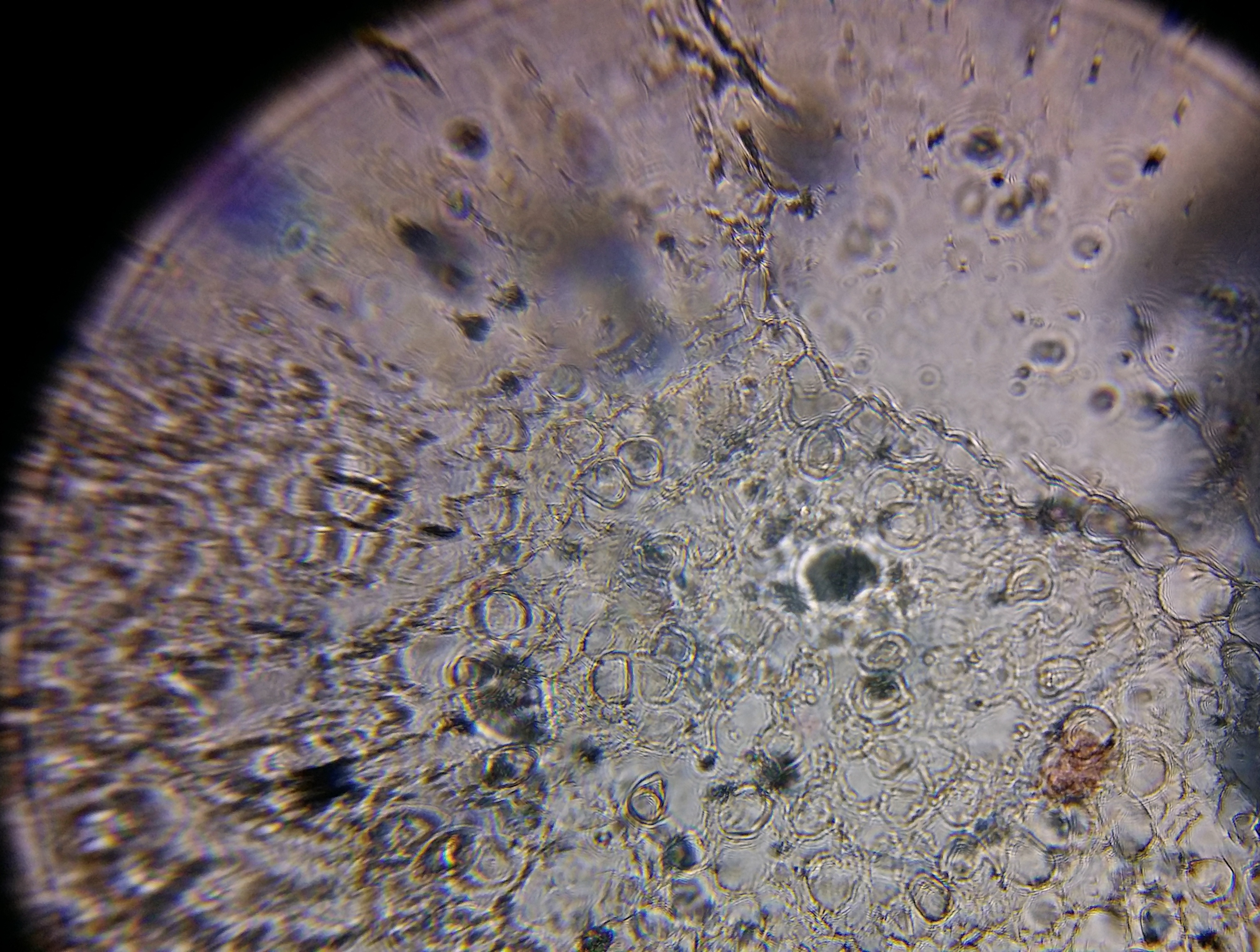Rhizobium-Bacteria-Root-Nodule.jpg