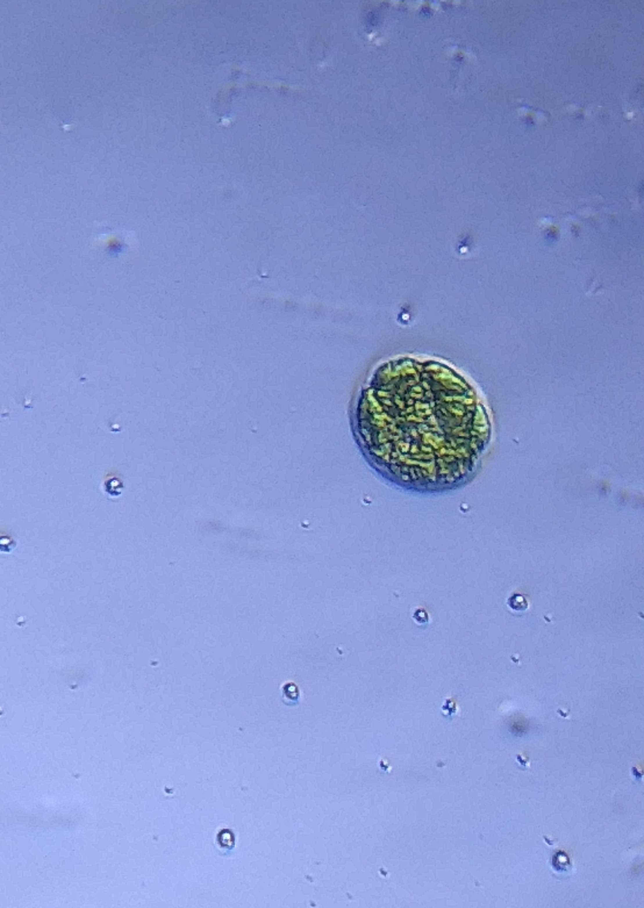 Single-celled-microalgae-under-foldscope.jpg