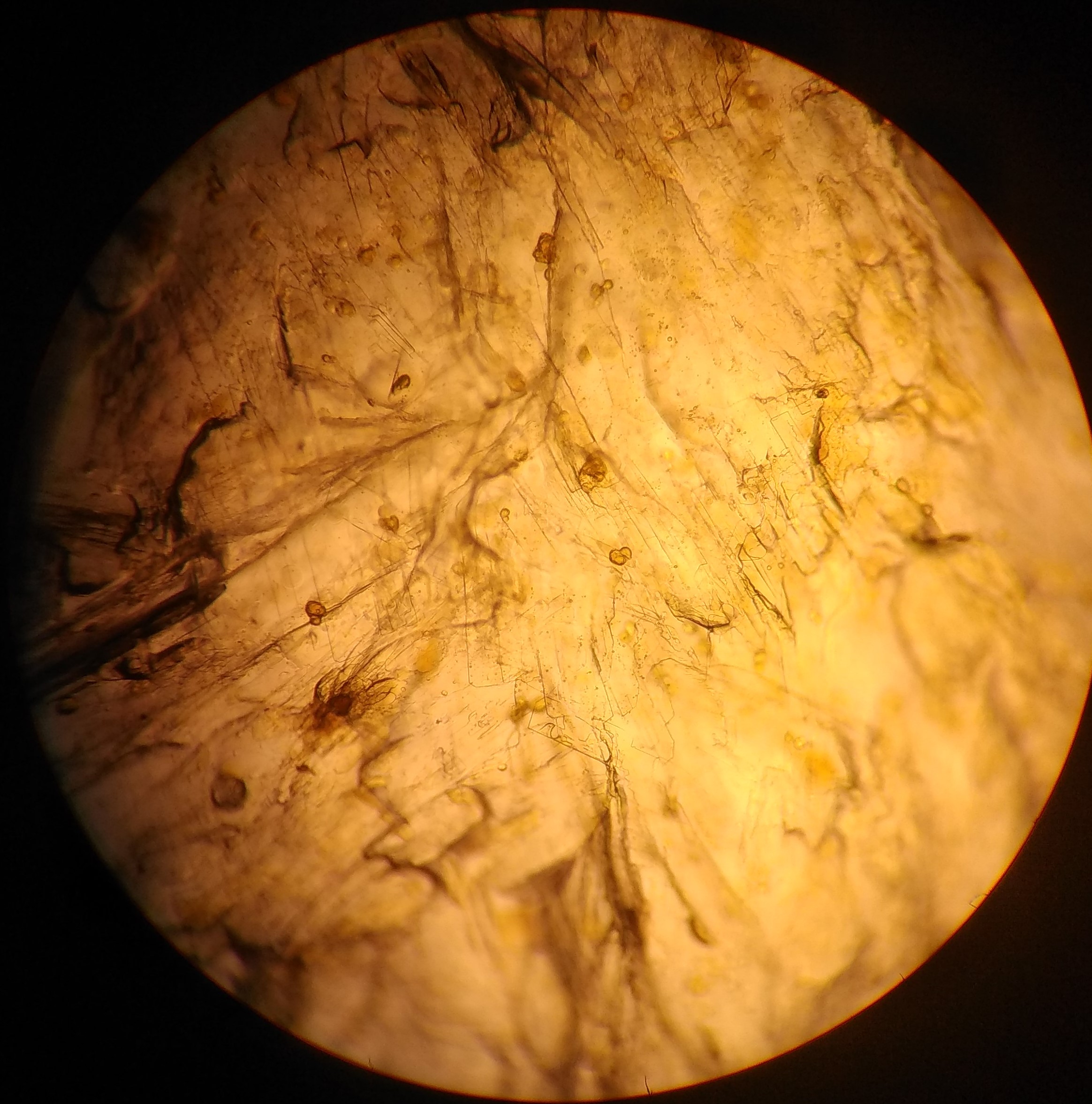 sucrose-osazone-crystals-foldscope.jpg