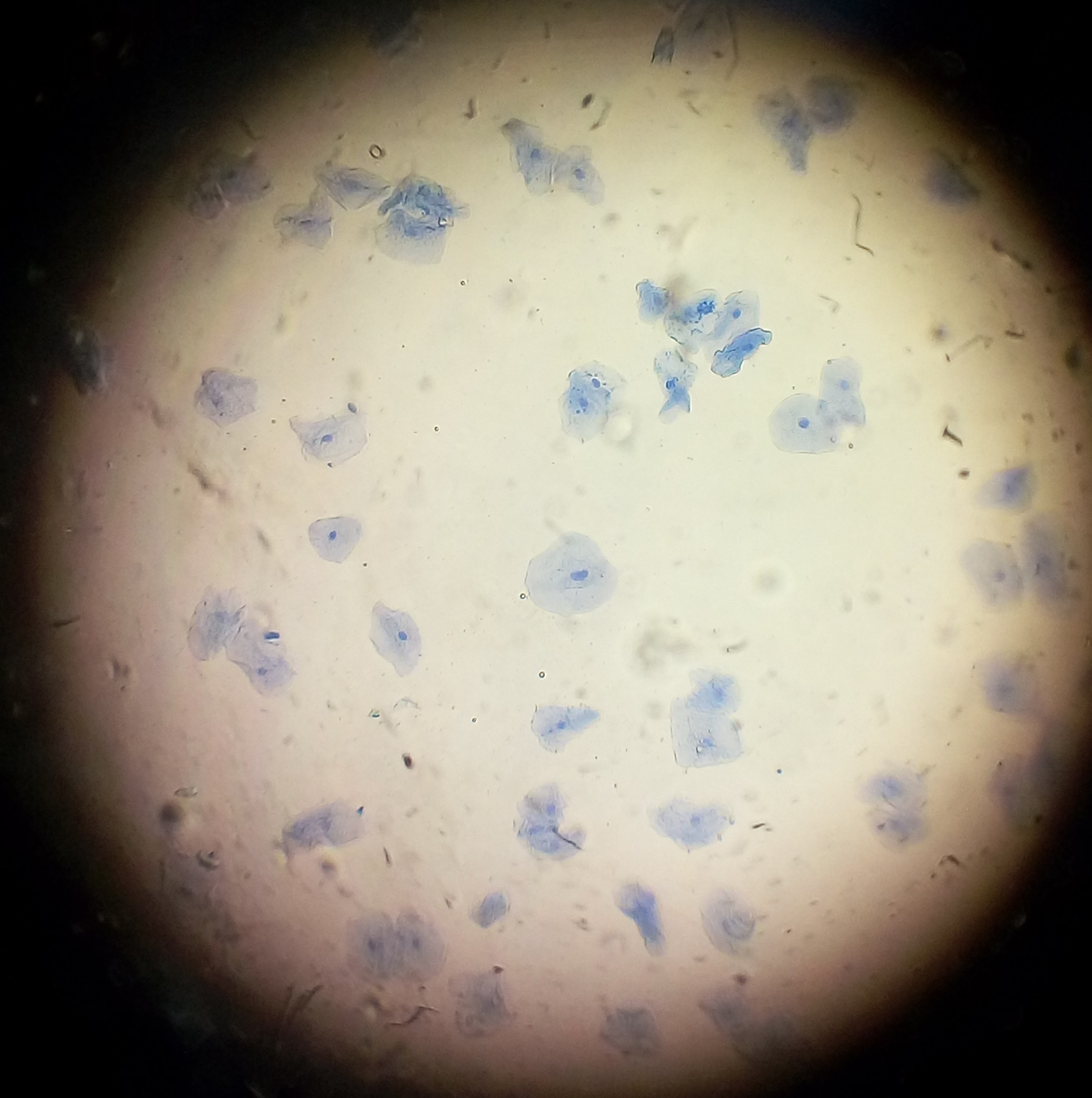 human-cheek-cells-Foldscope-microscope.jpg
