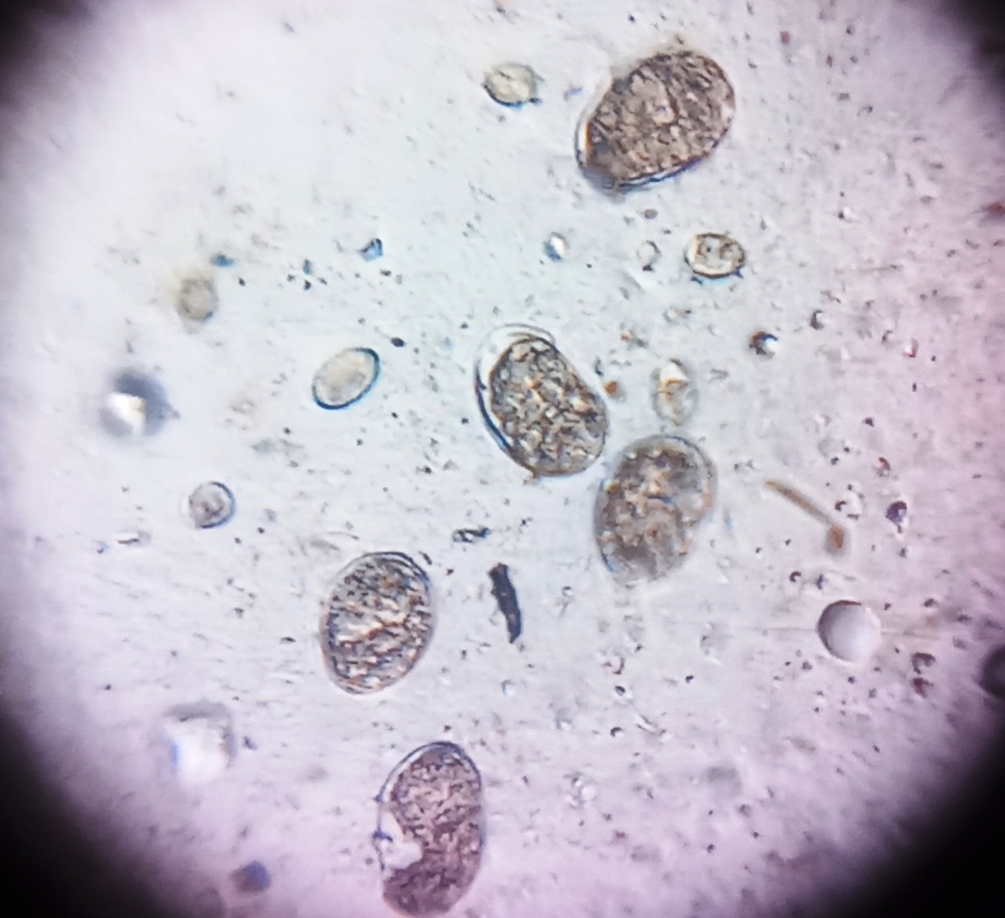 coccidia-Strongyle-eggs.jpg