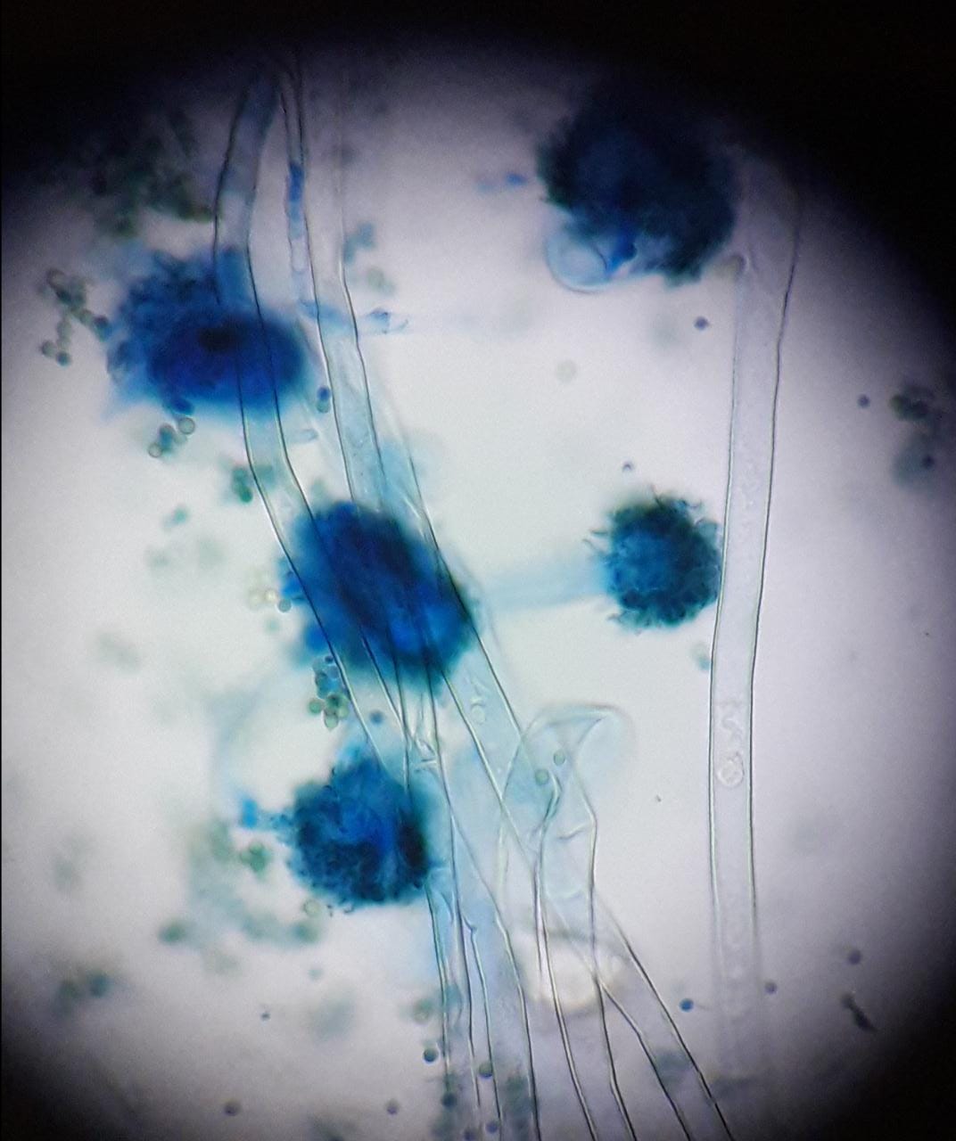 Aspergillus-Sp..jpg