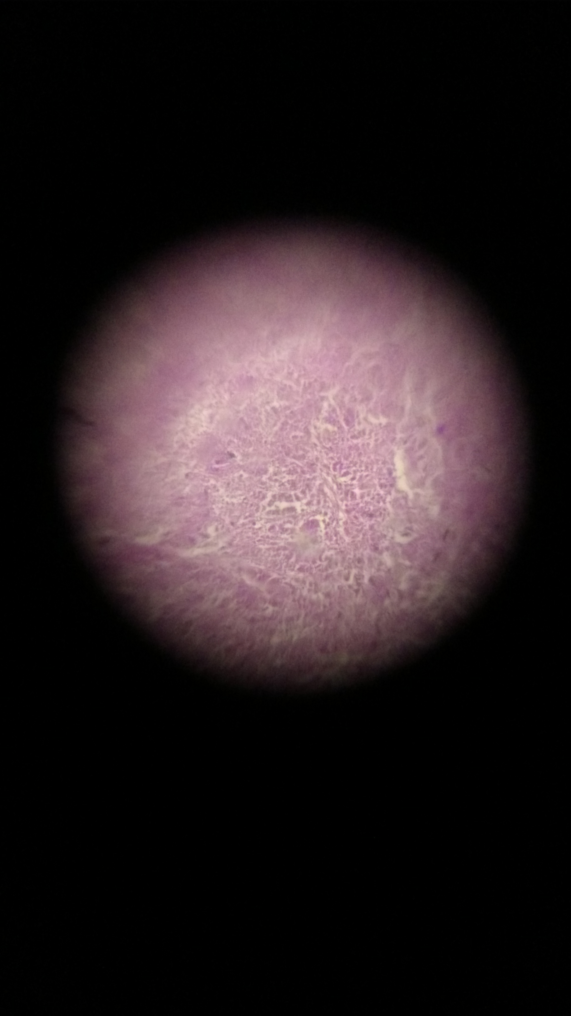 Nerve-cell.jpg