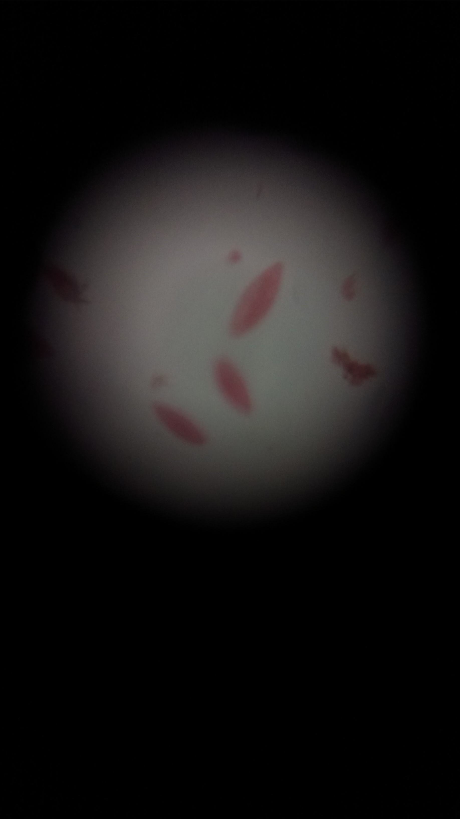 Paramecium-1.jpg