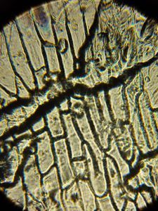 Thumbnail for LGP26 B-2 Onion Cells - Rahul