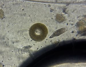 Thumbnail for Paramecium and an Unidentified Microbe