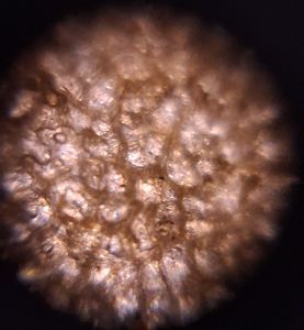 Thumbnail for Day 2 - LGP26 - B2 - Potato Peel