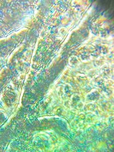 Thumbnail for THE FIRST