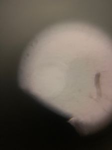 Thumbnail for Bog Observation