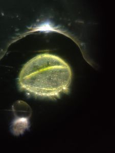 Thumbnail for LGP26:B4 - Pumpkin Pollen Dark Field