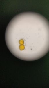 Thumbnail for LGP Day 3: Pollen grains and fibres