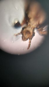 Thumbnail for பேன் உள்பகுதி 