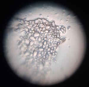 Thumbnail for Day 2 - LGP26 - B2 - Starch Grains