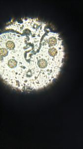 Thumbnail for Pollen grain