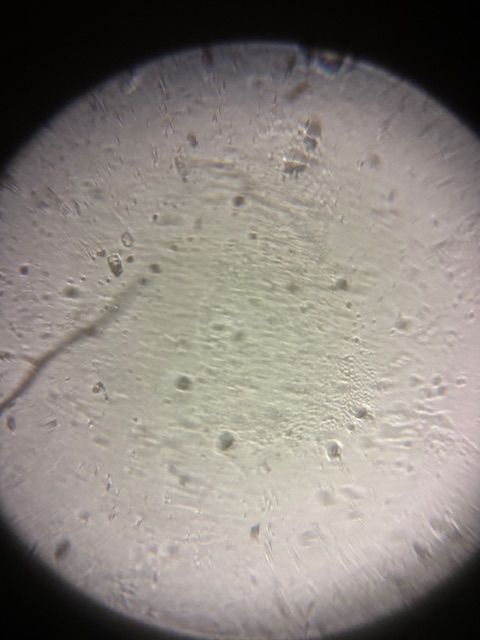 SINGLE IMAGE