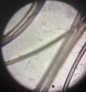Thumbnail for First Photo EVER with Foldscope
